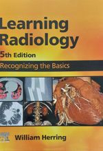 Learning Radiology: Recognizing the Basics