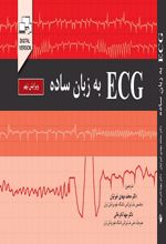 ECG به زبان ساده