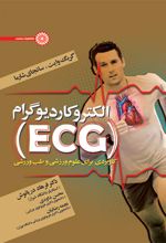 الکتروکاردیوگرام (ECG)