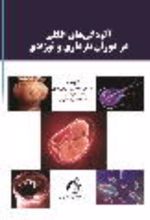 جلد کتاب آلودگی انگلی در دوران بارداری و نوزادی