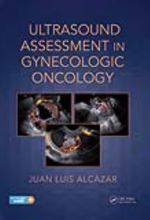 جلد کتاب Ultrasound Assessment in Gynecologic Oncology