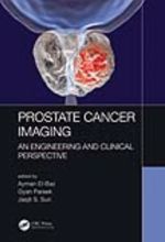 جلد کتاب Prostate Cancer Imaging