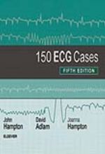 جلد کتاب 150 ECG Cases
