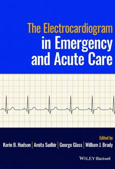 The Electrocardiogram in Emergency and Acute Care