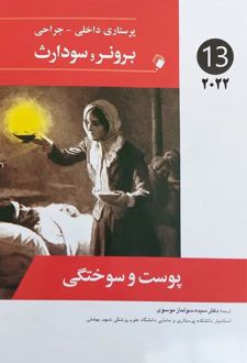 پوست و سوختگی