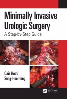 Minimally Invasive Urologic Surgery