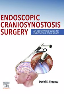 Endoscopic Craniosynostosis Surgery