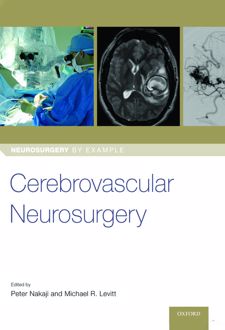 Cerebrovascular Neurosurgery