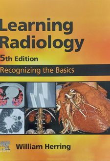 Learning Radiology: Recognizing the Basics