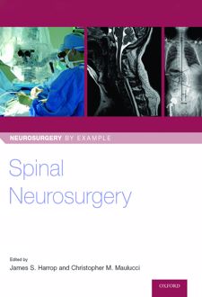 Spinal Neurosurgery