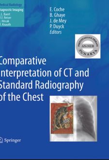 Comparative Interpretation of CT and Standard Radiography of the Chest