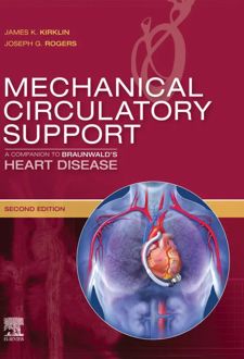 Mechanical Circulatory Support