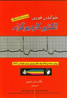خواندن فوری الکتروکاردیوگرام