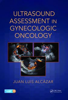 کتاب Ultrasound Assessment in Gynecologic Oncology