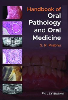 کتاب Handbook of Oral Pathology and Oral Medicine