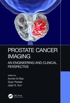 Prostate Cancer Imaging