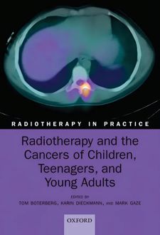 Radiotherapy and the Cancers of Children Teenagers and Young Adults