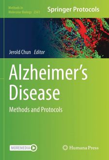 Alzheimer’s Disease
