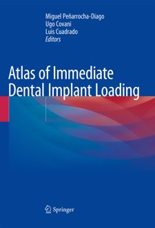 Atlas of Immediate Dental Implant Loading