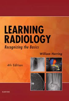 کتاب Learning Radiology
