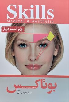 بوتاکس
