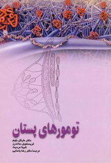 کتاب تومورهای پستان