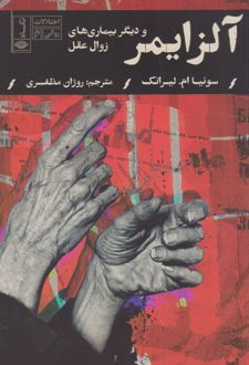 آلزایمر