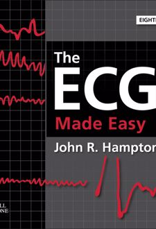 ECG Made Easy