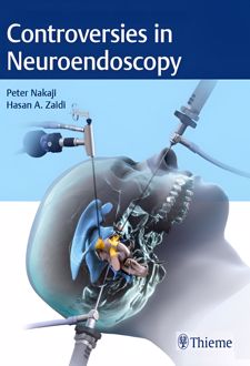 Controversies in Neuroendoscopy