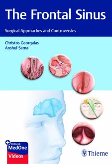کتاب The Frontal Sinus