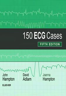 150 ECG Cases