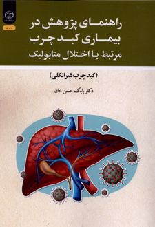 راهنمای پژوهش در بیماری کبد چرب مرتبط با اختلال متابولیک