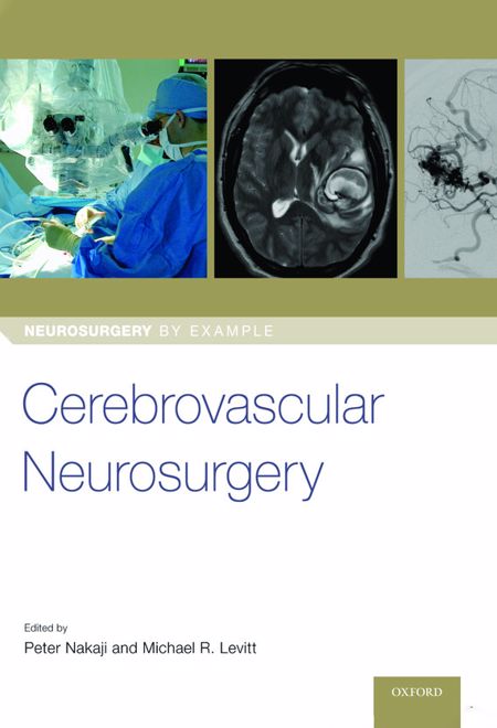 Cerebrovascular Neurosurgery