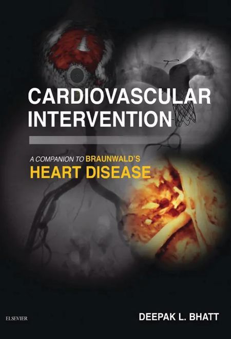 Cardiovascular Intervention