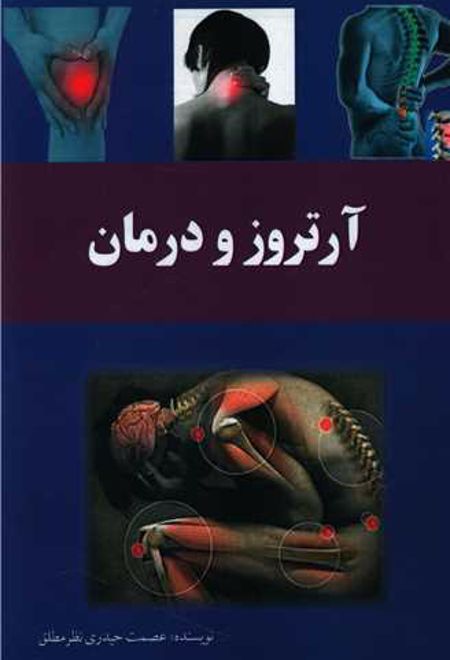 آرتروز و درمان