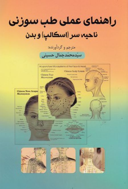 راهنمای عملی طب سوزنی ناحیه سروبدن