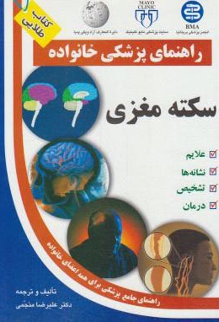 سکته مغزی