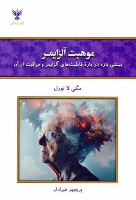 موهبت آلزایمر