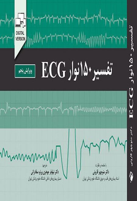 تفسیر 150 نوار ECG