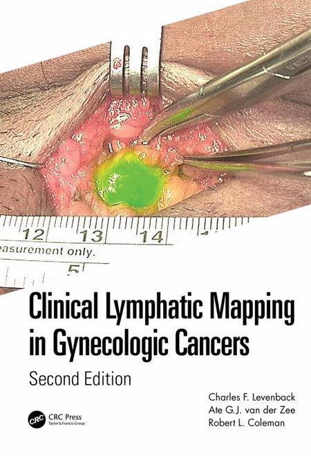 Clinical Lymphatic Mapping in Gynecologic Cancers