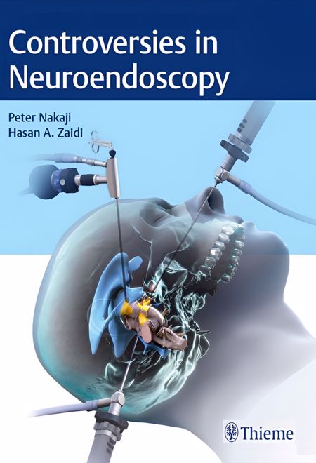 Controversies in Neuroendoscopy